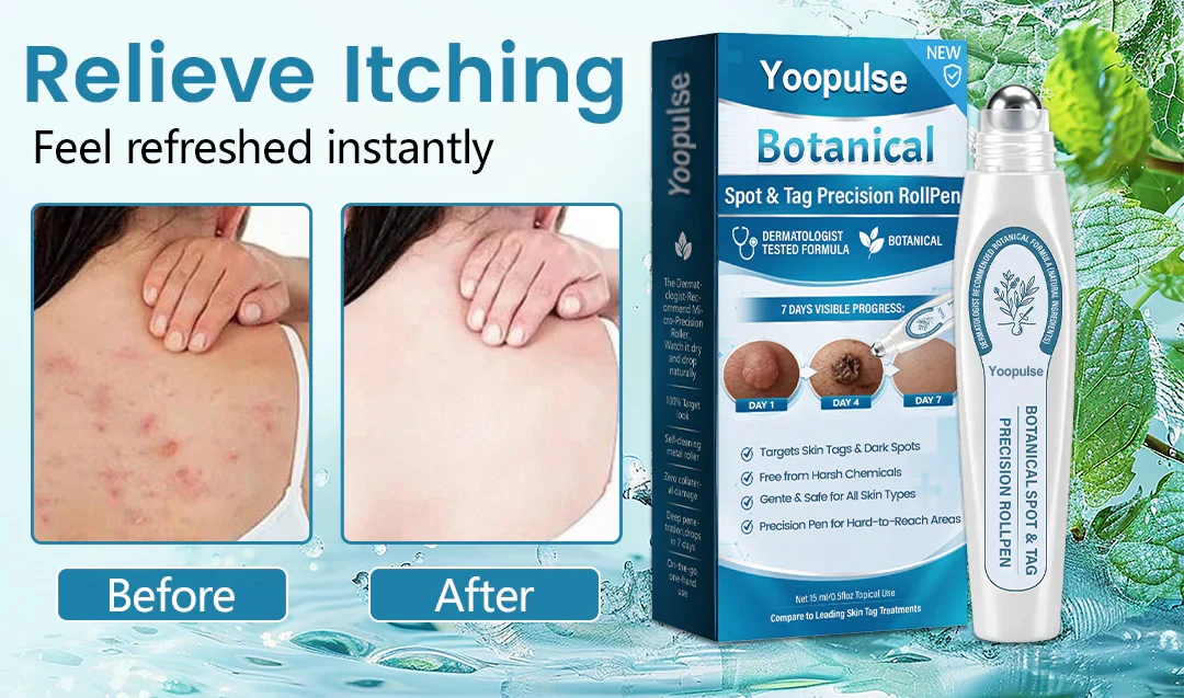 Yoopulse® Botanical Spot & Tag Precision RollPen