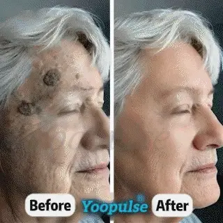 Yoopulse® Botanical Spot & Tag Precision RollPen