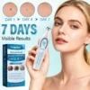 Yoopulse® Botanical Spot & Tag Precision RollPen
