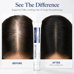 Yoopulse™ Hair Revival Serum