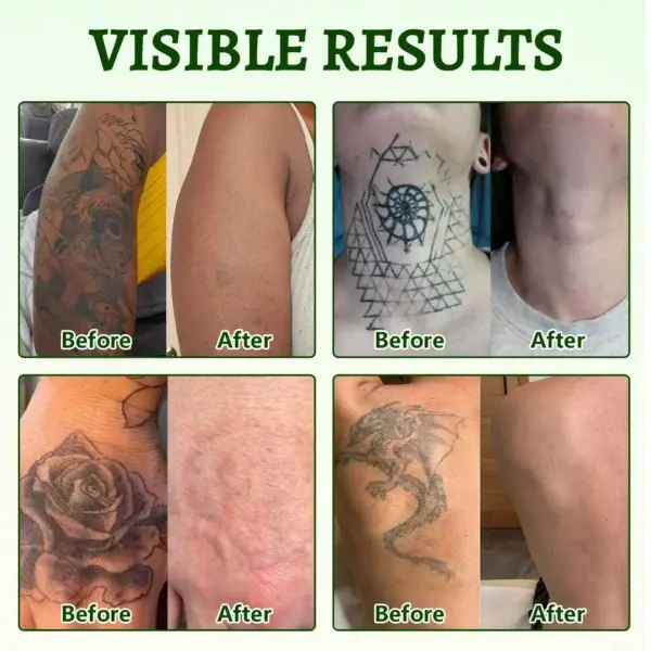 Yoopulse® PureAlgae Ink Removal Support Spray